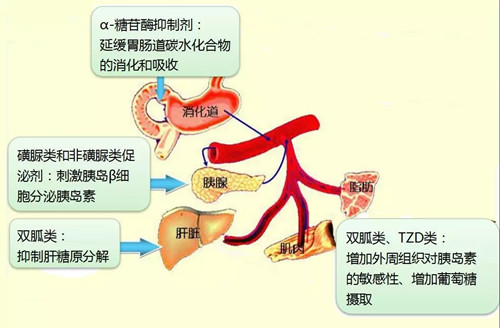 盘点:非胰岛素类降糖药都有哪些?