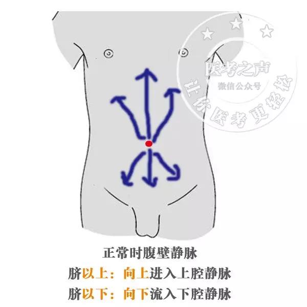 如此通透:看完本文,肝硬化的一切都明白了!